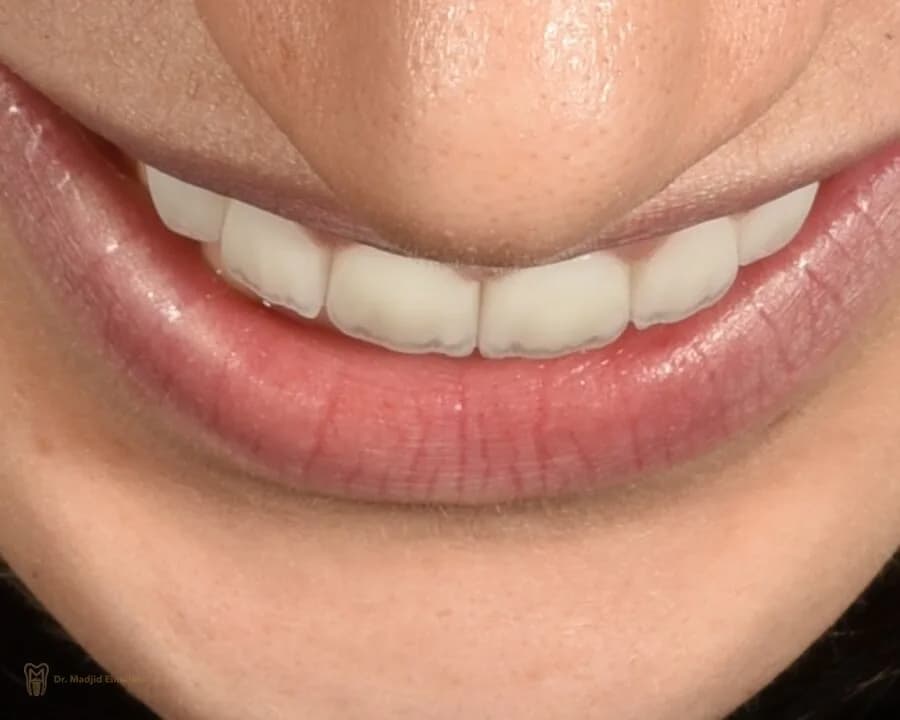 نمای نزدیک از لبخند بیمار